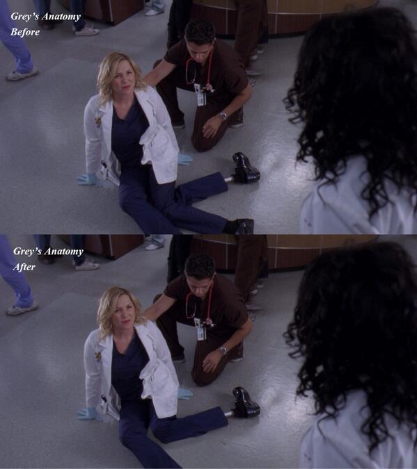 A look at Jessica Capshaw's Dr. Arizona Robbins's leg before-and-after post-production work