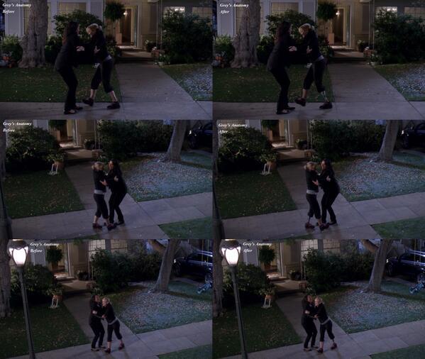 A look at Jessica Capshaw's Dr. Arizona Robbins's leg before-and-after post-production