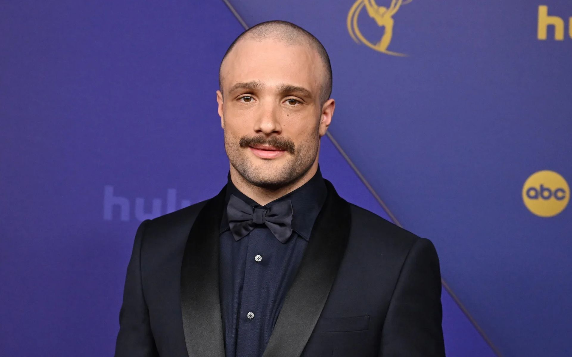 Cosmo Jarvis Illness: The Actor’s Quiet Battle With Type 1 Diabetes